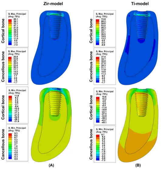 Figure 4. Results of principal stress with  regard to the vertical load in finite element  model in cross-section view