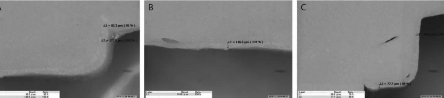 Figure  4.  Measurement  of  margin  and  internal  gap  using  digital  microscope  at  80  x  magnification
