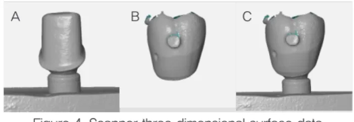 Figure 4. Scanner three dimensional surface data                (A) Titanium master die, (B) PMMA Crown                  (C) Superimposed crown on the master die