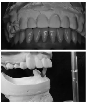 Figure 2. Rubber bite