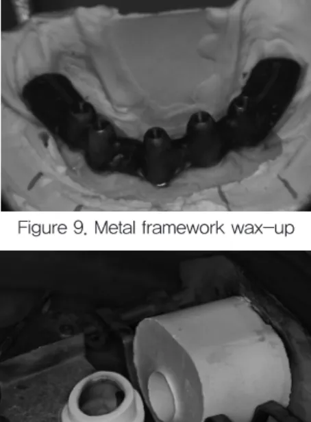 Figure 8. Putty index