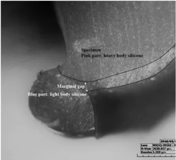 Figure  4.  A  photo  measured  at  160-magnification  using  the  digital  microscope