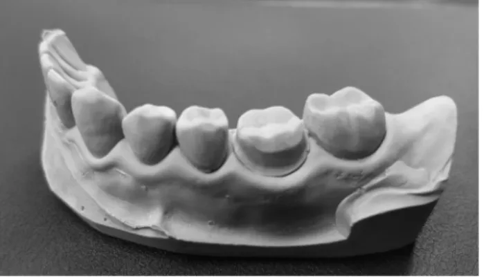 Figure 2. 3D printing model