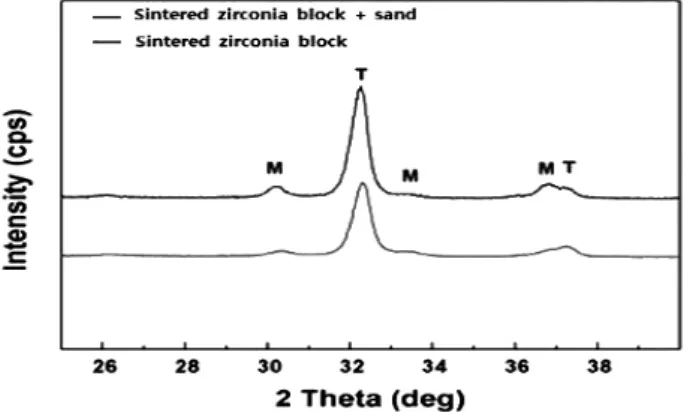 Fig. 13.  The  XRD  pattern  of  sand-blasting  treated                specimens. Ⅳ. 고  찰 전부 세라믹 수복물의 임상적인 성공은 코어와 전장 세라믹간의 결합강도에 많은 영향을 받는다