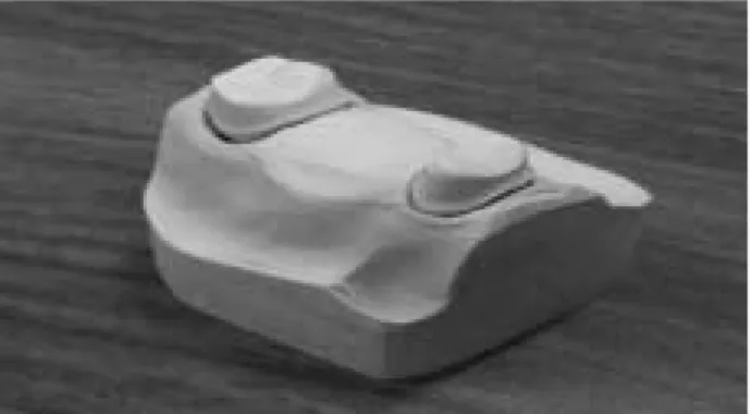 Fig. 1. The 3-unit bridge abutments gypsum model used in this study