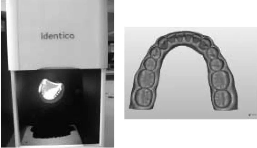Fig. 3. Non-contact optical scanner-based dental digital model(N=30)