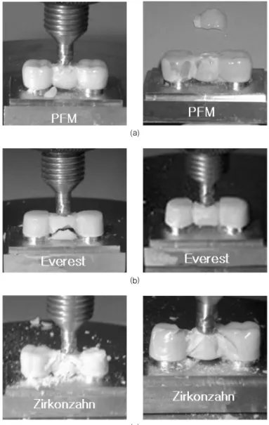 Fig. 3. Load-displacement curves of ⒜ PM, ⒝ EV and