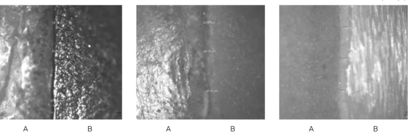 Fig. 2. Observation of marginal discrepancy using microscope (magnification ×100): (Metal-ceramic alloy1, IPS - Empress1, Zirconia1)