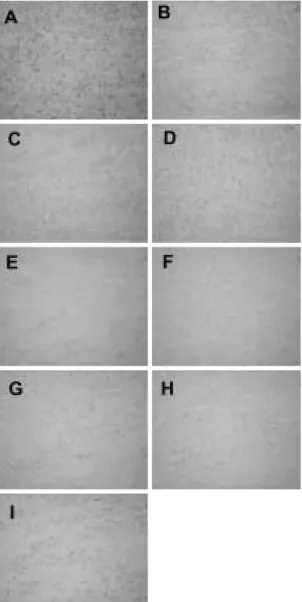 Fig 4. Changes  in  the  X-ray  diffraction pattern  during  isothermal  ageing  at 400℃.