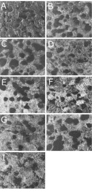 Fig 6. Scanning  electron  microscopic photographs  of  the  specimens solution-treated (A), aged at 300℃ for 1,000min(B),  5,000min(C),  50,000min (D), 350℃ for 100min(E), 50,000min(F), 400℃ for  5min(G),  50min(H)  and 50,000min(I).