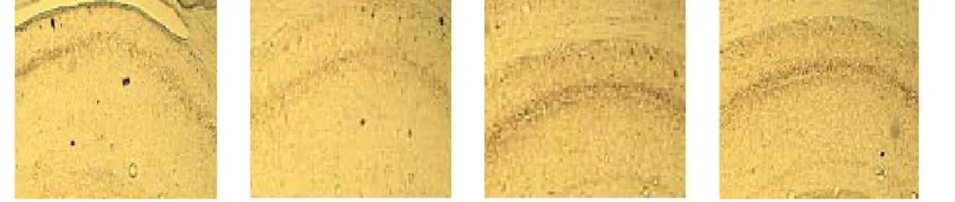 Fig. 9. The  values  of  density  of  acetylcholine  esterase(AchE)  stained  nuclei  in  the  CA1  in  the  hippocampal  formation  areas  are  shown