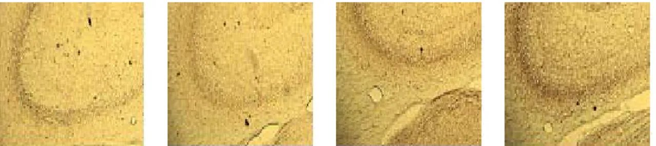 Fig. 11. The  values  of  density  of  acetylcholine  esterase(AchE)  stained  nuclei  in  the  CA3  in  the  hippocampal  formation  areas  are  shown