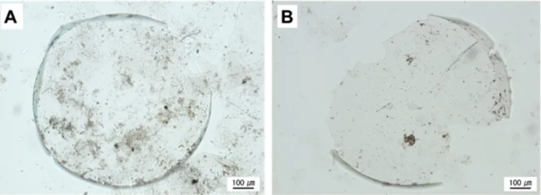 Fig. 1. Microphotographs of Ethmodiscus rex fragments with less damage and relatively intact form at 46-47 cm interval of core PC 03-01-02 pilot.