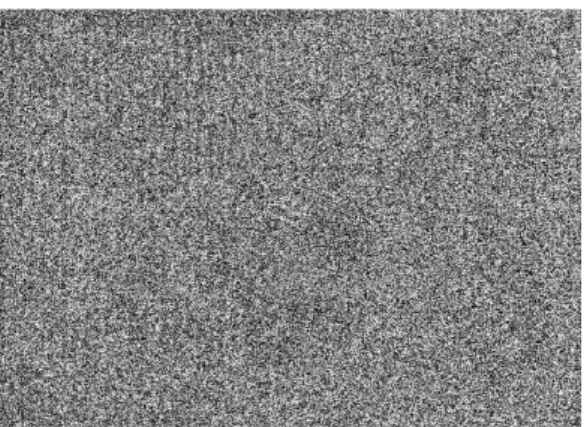 Fig 6.  원추대에 부착된 Wax Pattern