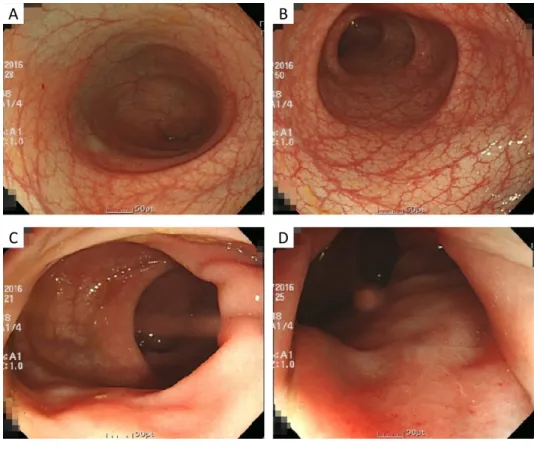 Fig.  2.  Colonoscopy  on  12  Dec  2016.