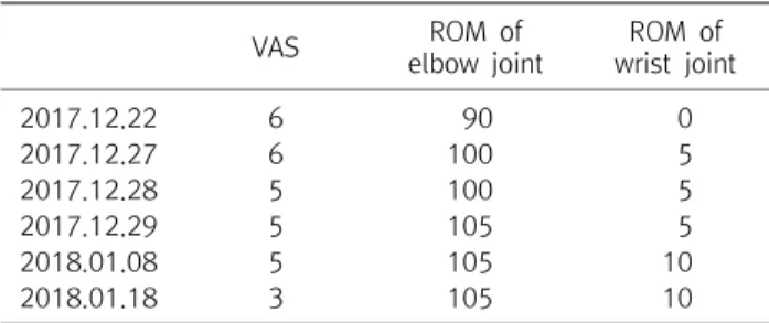 Table  1.  Result VAS ROM  of  elbow  joint ROM  of  wrist  joint 2017.12.22 6 90 0 2017.12.27 6 100 5 2017.12.28 5 100 5 2017.12.29 5 105 5 2018.01.08 5 105 10 2018.01.18 3 105 10 9