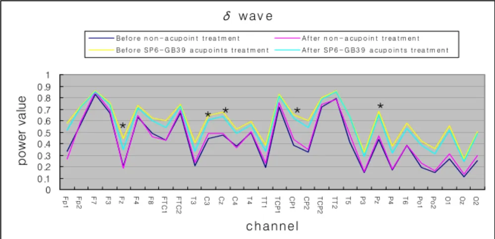 Figure  5.  Topographical  display  of  EEG  activity  within  th  δ  range  due  to  EA  treatment