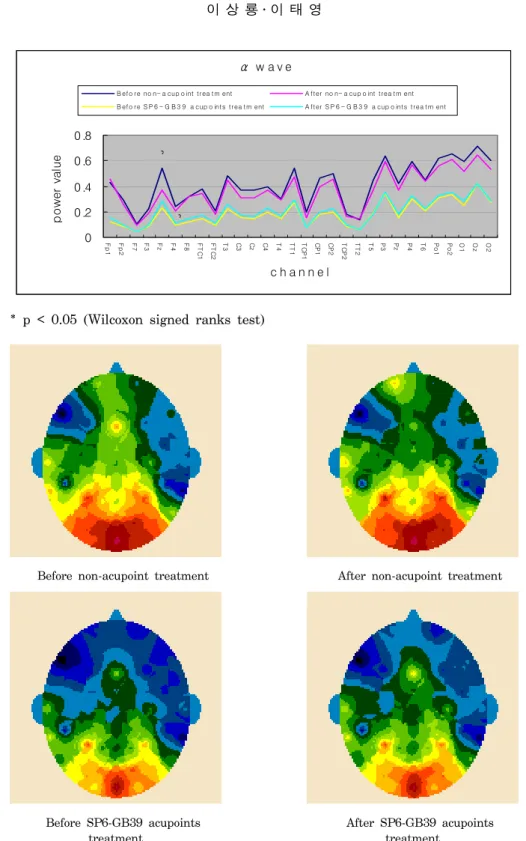 Figure 2. Topographical  display  of  EEG  activity  within  the  range  due  to  EA  treatment
