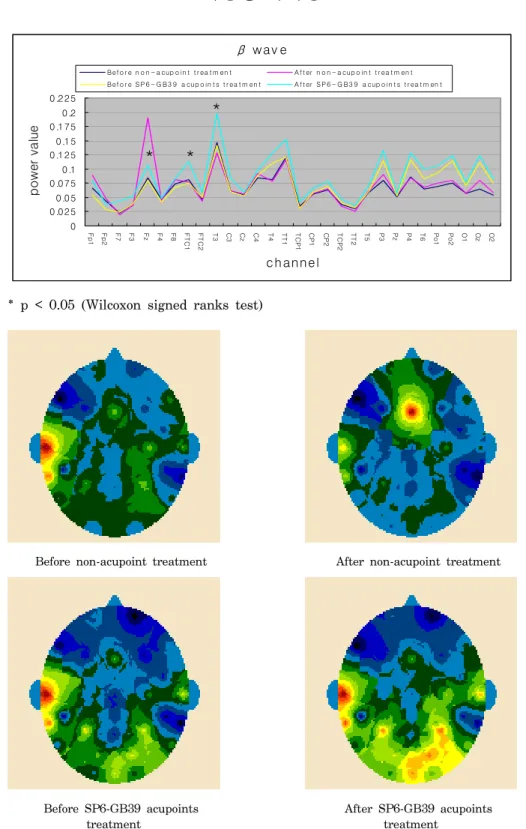 Figure 3. Topographical  display  of  EEG  activity  within  the  β  range  due  to  EA  treatment