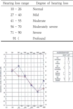 Fig.  3.  Pure-Tone  Audiometry  Result(2020.10.16)
