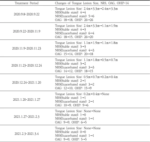 Table  6.  Treatment  Periods  and  Changes  of  Tongue  Lesion  Size,  NRS,  OAG,  OHIP-14(OPD  Tx) 결핵,  성홍열과  같은  세균성,  사람면역결핍바이러스 (Human immunodeficiency virus)와 같은 바이러스, 진균류  등의  감염,  고열,  화학적  자극  등에  의한  손상, 이외  원인  미상의  병인에  의해  발생한다4,17)