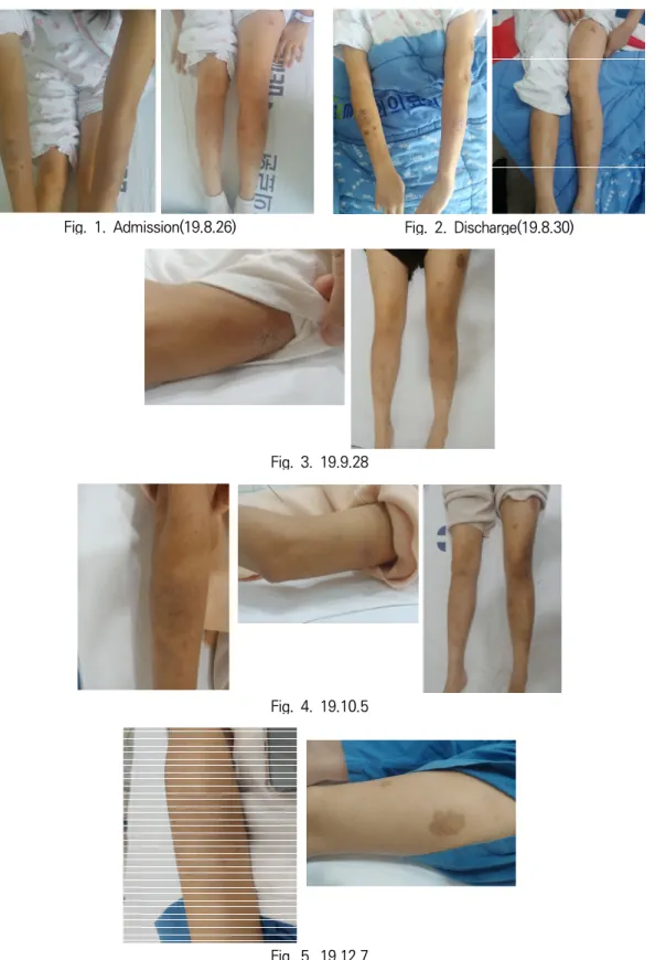 Fig.  1.  Admission(19.8.26)  Fig.  2.  Discharge(19.8.30) 