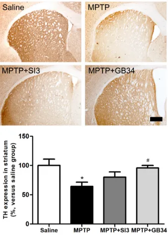 Fig.  4.  Neuroprotective  effects  of  acupuncture  stimulation  at  GB34  in  the  striatum