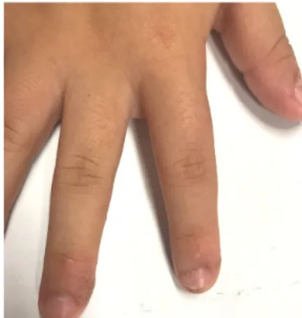 Fig.  3.  Photograph  of  Skin  Status  (2019.11.9) 