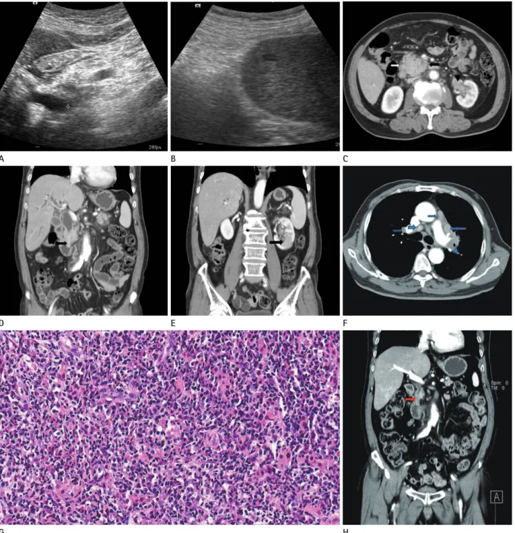 Fig. 1. A 67-year-old man presenting with jaundice and poor oral intake. 