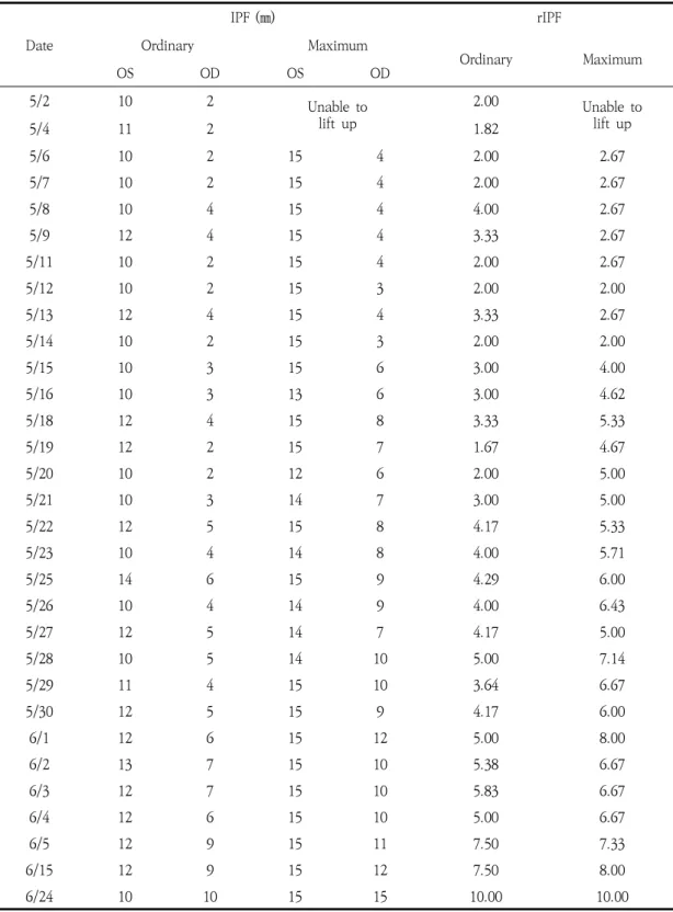 Table  2.  The  Progress  of  Rt.  Ptosis Date IPF  (㎜) rIPFOrdinaryMaximum Ordinary Maximum OS OD OS OD 5/2 10  2  Unable  to  lift  up 2.00  Unable  tolift  up 5/4 11  2  1.82  5/6 10  2  15  4  2.00  2.67  5/7 10  2  15  4  2.00  2.67  5/8 10  4  15  4 