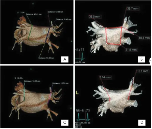 Fig.  2.  Comparison of parameters in Afib group (A and  C) with non-Afib group (B and D).