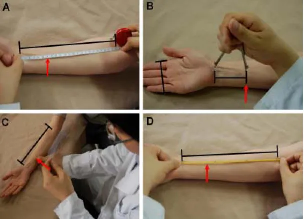 Fig 1. Locating APs PC5 in the arm using four kinds of locating APs methods: one Conventional  Ruler method (A) and three alternative methods including Cunometer (B), Transparent AP  meter  (C), and Elastic Ruler method (D)