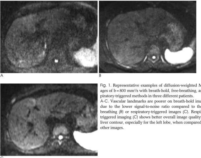 Table 3. Results of Qualitative Analysis for the Three Diffusion-Weighted MR Imaging Techniques Using a 4-Grade Scale for Each Analysis
