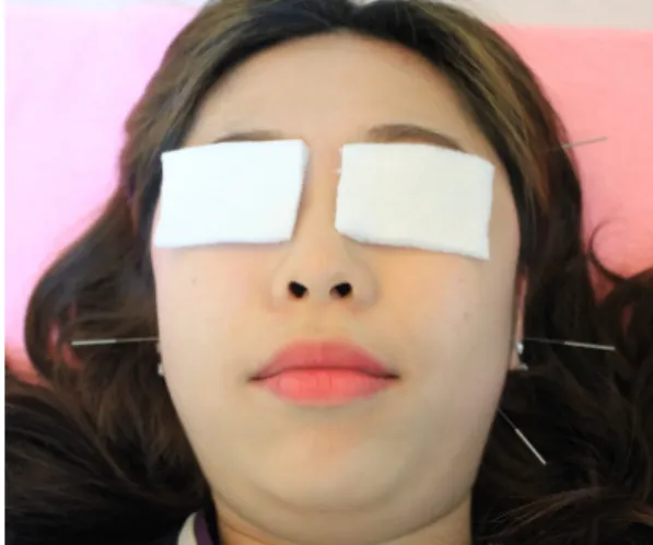 Fig.  1.  Motion  Style  Treatment.