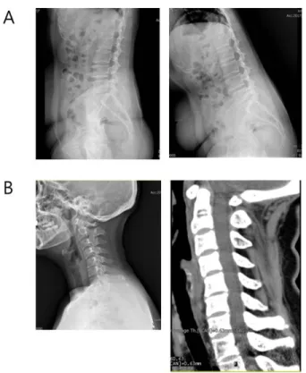 Fig.  3.  Radiological  test  of  Case  2.