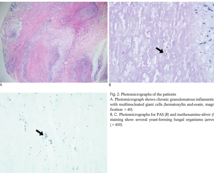 Fig. 2. Photomicrographs of the patients