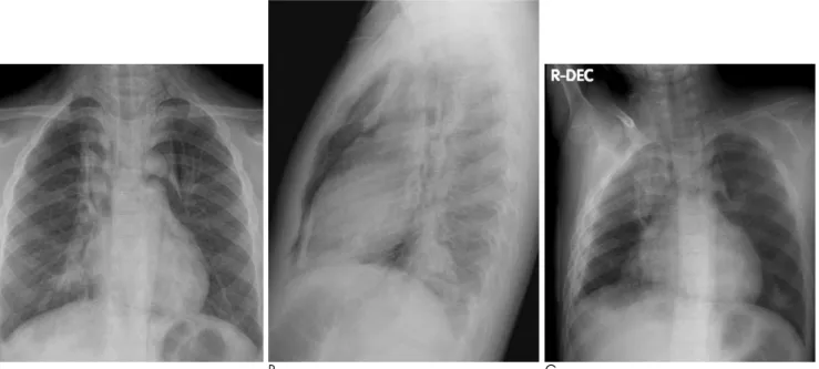 Fig. 2. A 7-year-old boy who presented with dyspnea and had a history of allergic rhinitis.