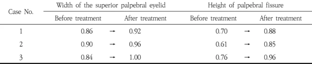 Table  2.  Objective  Symmetry  Score  From  3  Cases  of  Oro-Ocular  Synkinesis 