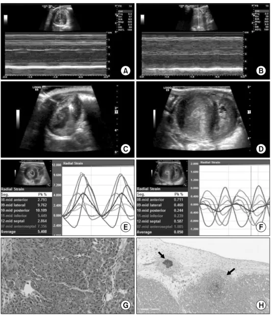 Fig. 2. A donor heart (37.5 g) from a transgenic pig ( 1,3-galactosyltransferase gene-knockout, blood type A, 6.4 kg) expressing human complement regulatory protein CD46 was transplanted into a cynomolgus monkey (blood type A, 5.3 kg)