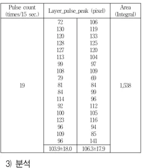 Table  5.  Values  of  data  processing  after  optical  coherence  tomography  in  Chon  region  of  case  1 