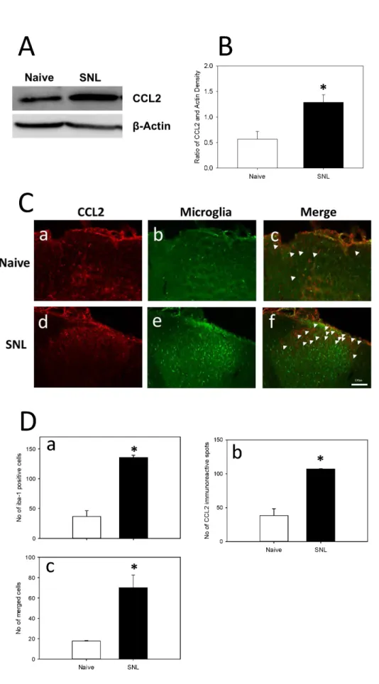 Fig.  3.  Expression  of  CCL2  and  microglia in Naïve and SNL animals.