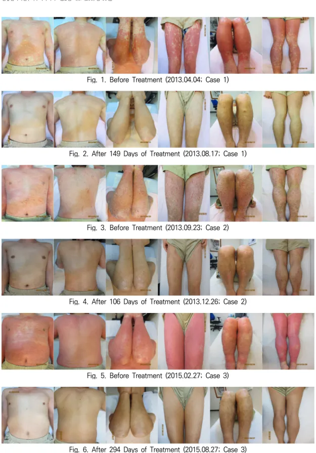 Fig.  1.  Before  Treatment  (2013.04.04;  Case  1)
