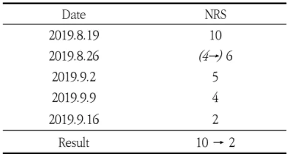 Table  1.  Change  of  NRS(Case  1)