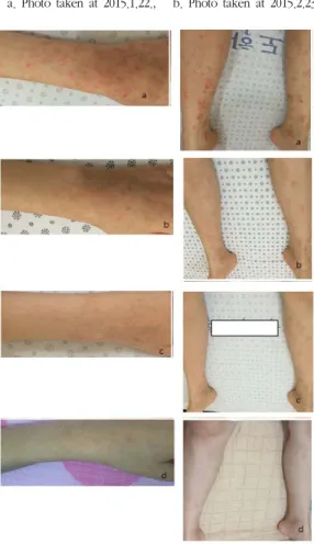 Fig 5. Changes in Arm Skin Photo.