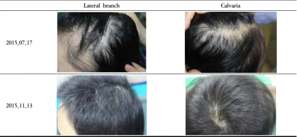 Fig. 1. Progress of Case 1