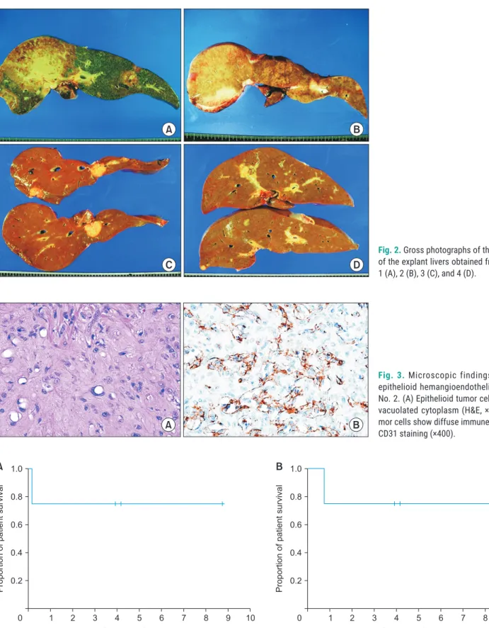 Fig. 2. Gross photographs of the cut surface  of the explant livers obtained from case No