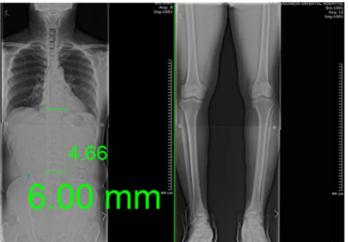 Fig.  5.  Change  of  radiograph  at  after  3 rd   treatment(Case  1).