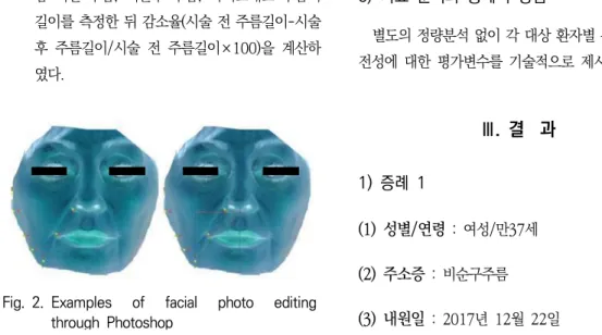 Fig. 2. Examples  of  facial  photo  editing  through  Photoshop           • 아래 눈확주름 : 목내자(目內眥; 눈의 안쪽 경계)에서  눈확  아래로  형성된  주름의  끝점까지의  곡선  길이      • 뺨  이완  주름  :  목내자에서  뺨  연부조직  이완으로  형성된  주름의  끝점까지의  직선길이      • 비순구  주름  :  콧방울  윗점에서  비순구  주름  끝점가지의  직선길