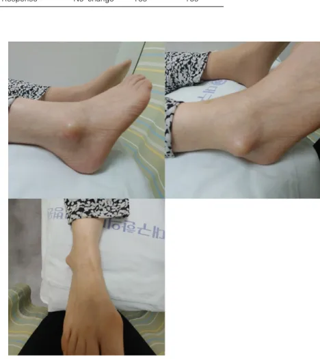 Table 1. Response Evaluation Criteria for Malleolar Bursitis of the  Ankle 4)