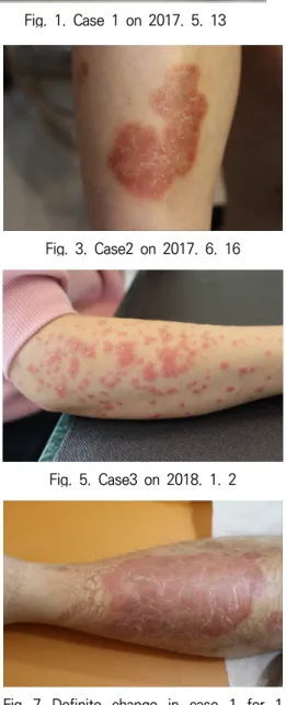 Fig.  3.  Case2  on  2017.  6.  16 Fig.  4.  Case  2  on  2017.  11.  21